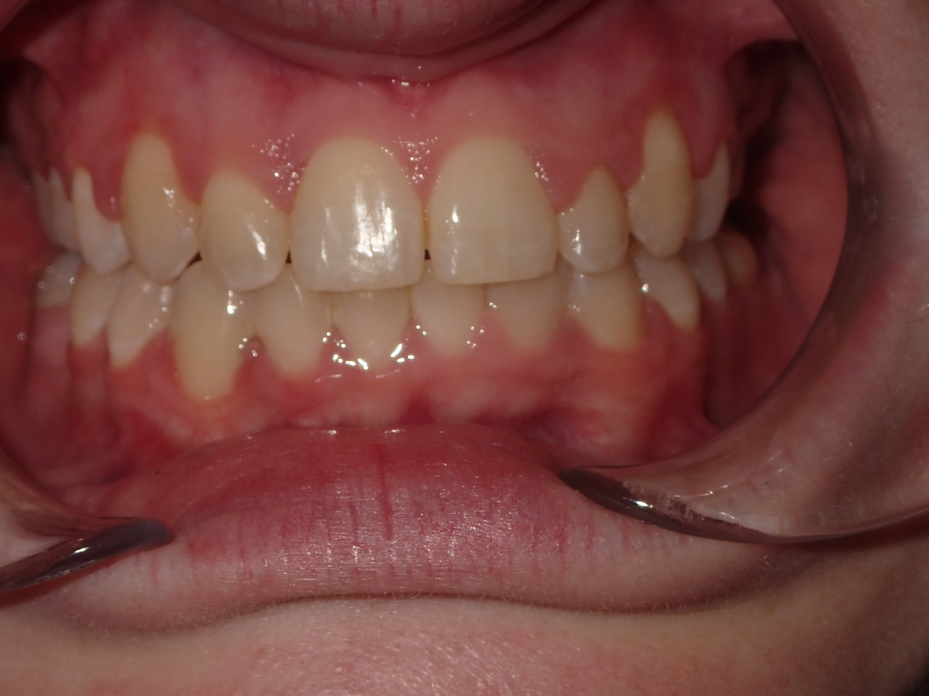 Eldora Family Dentistry & Orthodontics | Periodontal Treatment, Teeth Whitening and Pediatric Dentistry