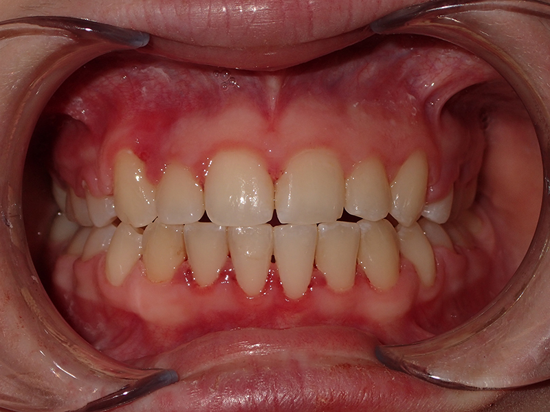 Eldora Family Dentistry   Orthodontics | Perio Protect reg , Pediatric Dentistry and Implant Dentistry