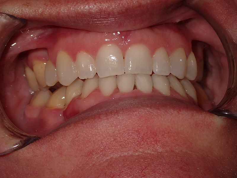 Eldora Family Dentistry   Orthodontics | Cosmetic Dentistry, Sedation Dentistry and Pediatric Dentistry