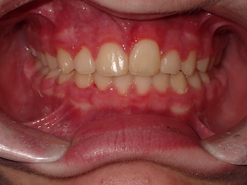 Eldora Family Dentistry   Orthodontics | Root Canals, Extractions and Implant Dentistry