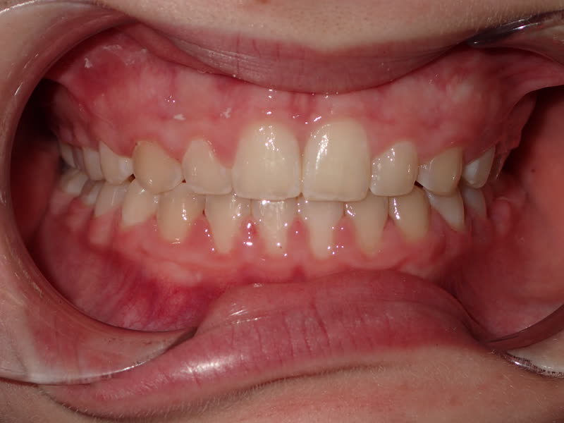 Eldora Family Dentistry   Orthodontics | Ceramic Crowns, Dental Fillings and Extractions