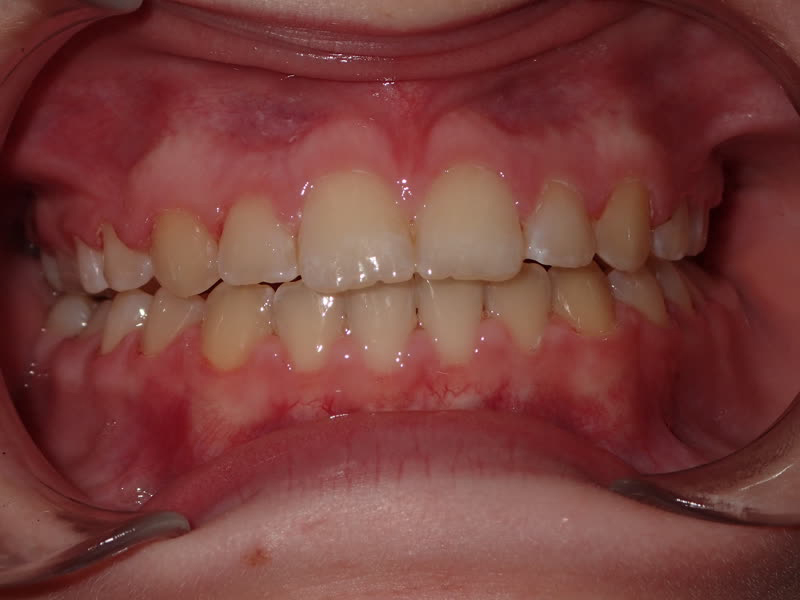 Eldora Family Dentistry   Orthodontics | Sports Mouthguards, Root Canals and Oral Cancer Screening