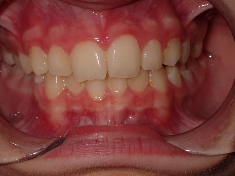 Eldora Family Dentistry   Orthodontics | Sports Mouthguards, Oral Exams and Sedation Dentistry