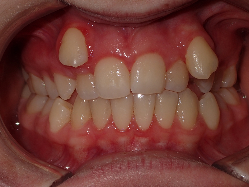 Eldora Family Dentistry   Orthodontics | Preventative Program, Implant Dentistry and Periodontal Treatment