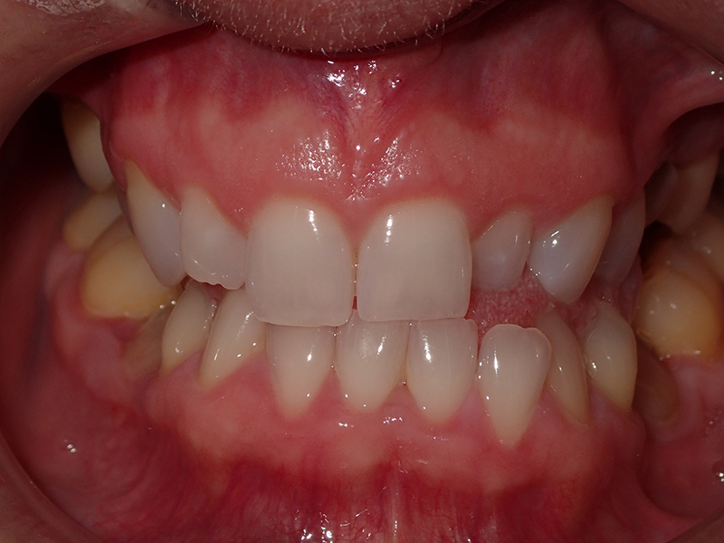 Eldora Family Dentistry   Orthodontics | Pediatric Dentistry, Extractions and Preventative Program