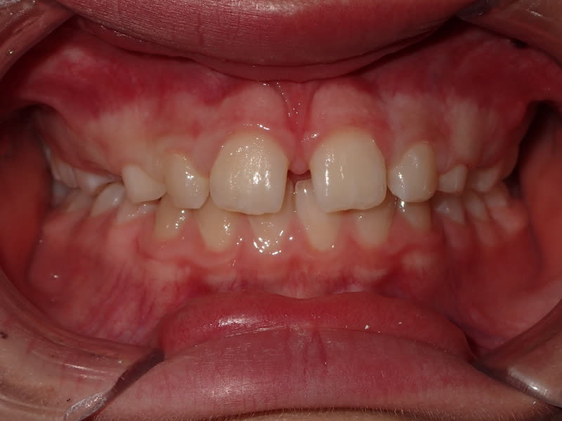 Eldora Family Dentistry   Orthodontics | Root Canals, Implant Dentistry and Teeth Whitening