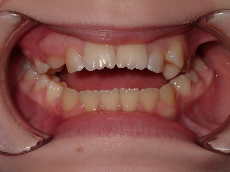 Eldora Family Dentistry   Orthodontics | Cosmetic Dentistry, Root Canals and Emergency Treatment