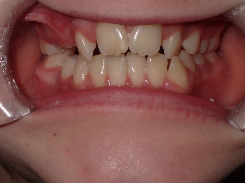 Eldora Family Dentistry   Orthodontics | Digital Radiography, Ceramic Crowns and Cosmetic Dentistry