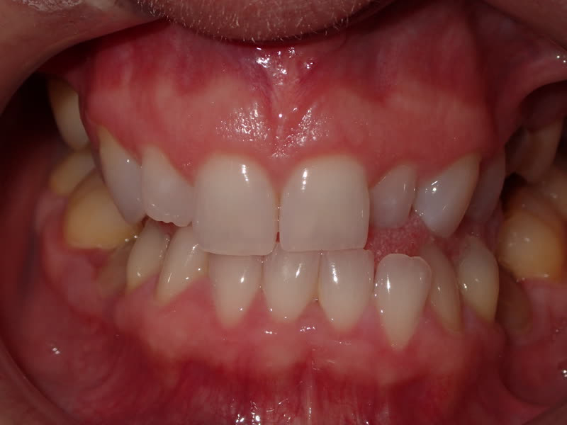 Eldora Family Dentistry   Orthodontics | Teeth Whitening, Night Guards and Root Canals