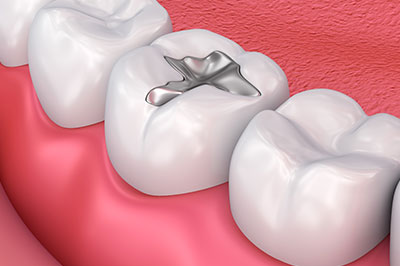 Eldora Family Dentistry   Orthodontics | Dental Bridges, Cosmetic Dentistry and Oral Exams