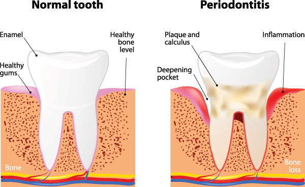 Eldora Family Dentistry   Orthodontics | Emergency Treatment, Ceramic Crowns and Dental Bridges