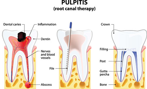 Eldora Family Dentistry   Orthodontics | Ceramic Crowns, Teeth Whitening and Dental Bridges